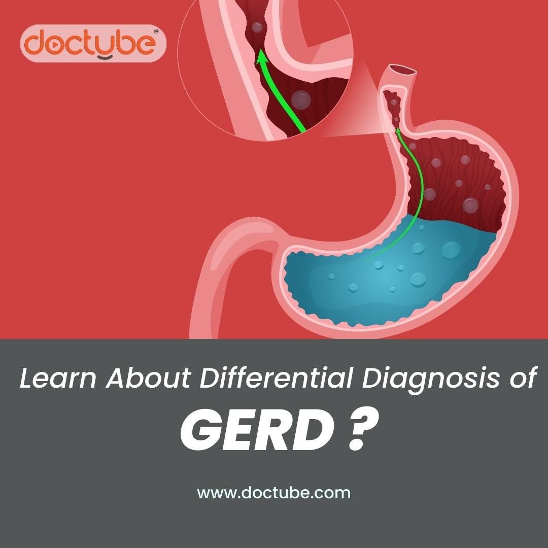 Learn about the differential diagnosis of GERD. DocTube Medium