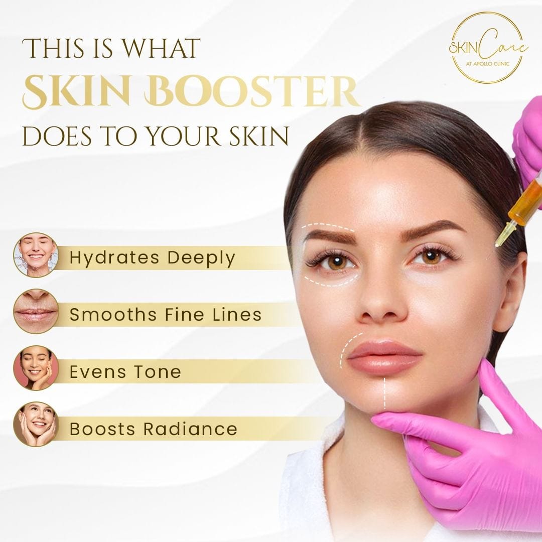 The Ultimate Guide To Skin Boosters Revitalize Your Skin From Within The Ultimate Guide To Skin Boosters Revitalize Your Skin From Within