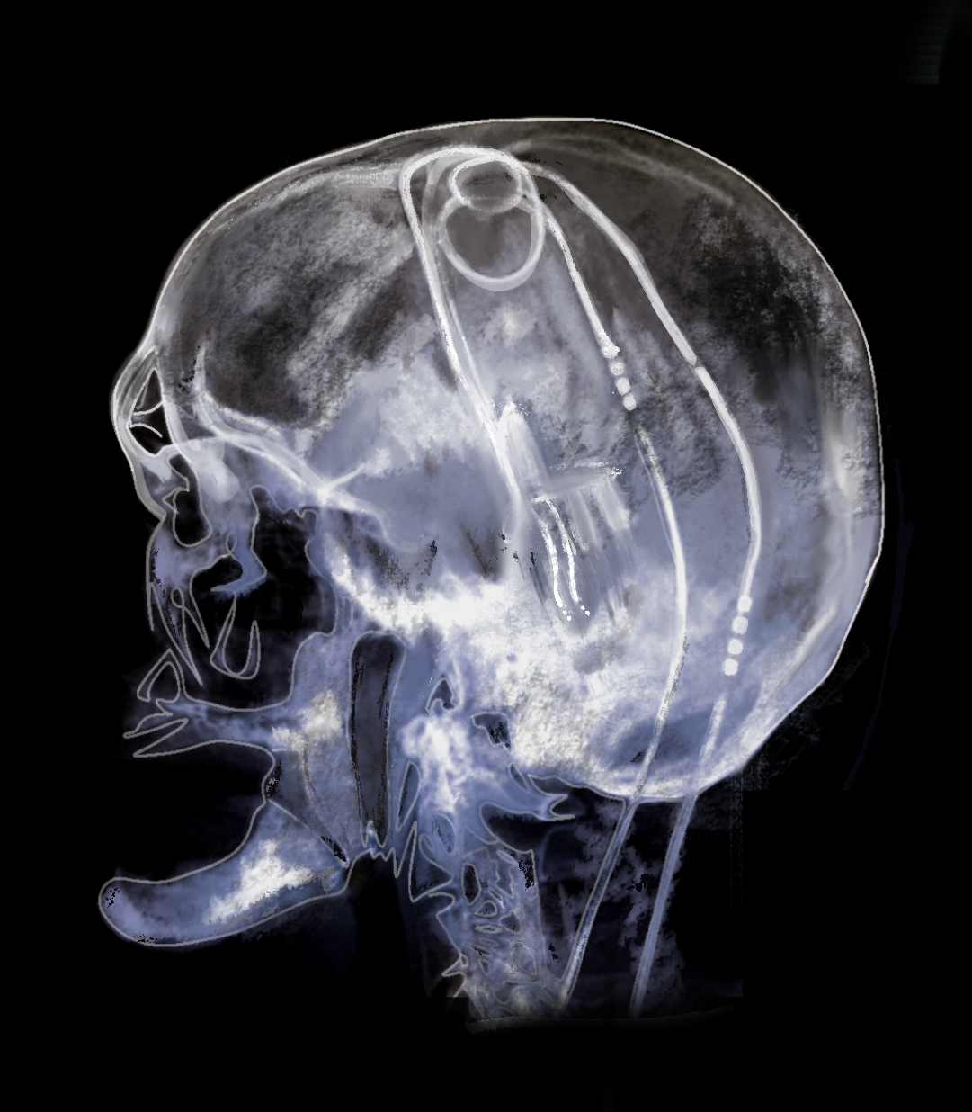 You’ve Never Heard of the Most Important Part of Your Brain by