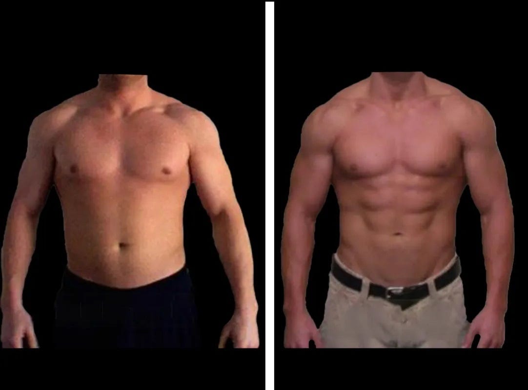 How Long Does ABS Surgery Last?. This article will explain how long