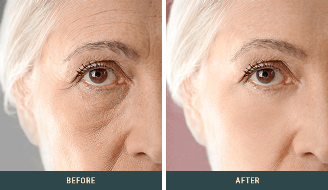 the-anti-aging-secret-dermatologists-don-t-want-you-to-know-face