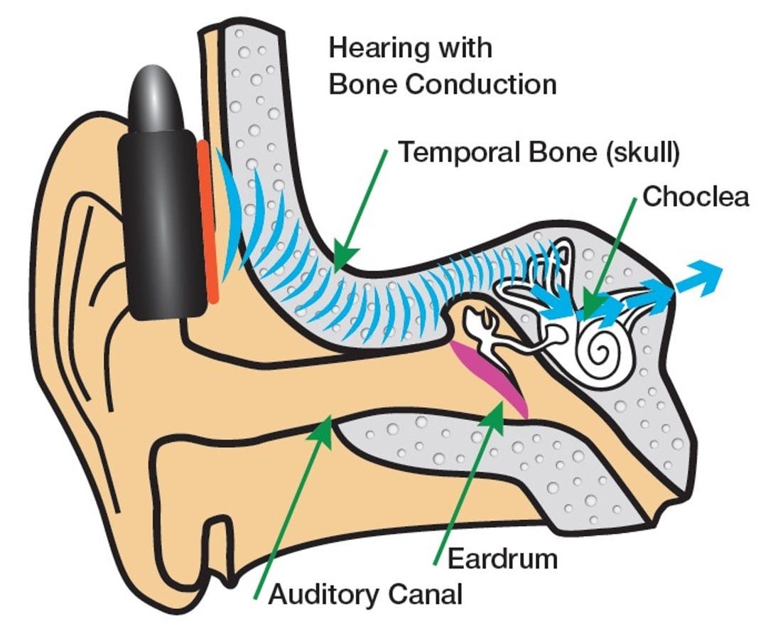 What Are the Disadvantages of Bone Conduction Headphones and How about Their Pros and Cons by