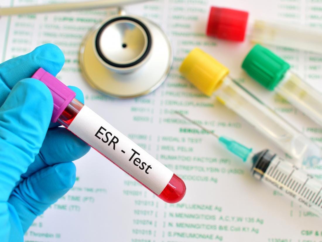 ESR Test Price, Preparation & Report Interpretation