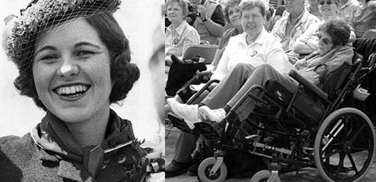 Rosemary Kennedy After Lobotomy rosemary-kennedy-after-lobotomy