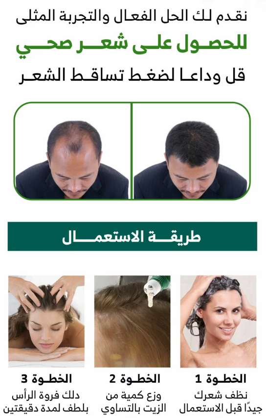 أفضل علاج لتساقط الشعر للرجال والنساء في السعودية | Medium
