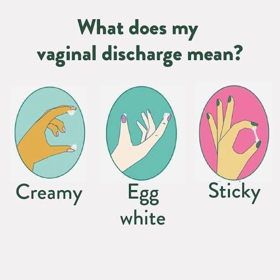 What Is Vaginal Discharge?
