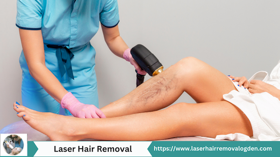 Laser Hair Removal Ogden Skin Care Center by Chyasiratd Medium