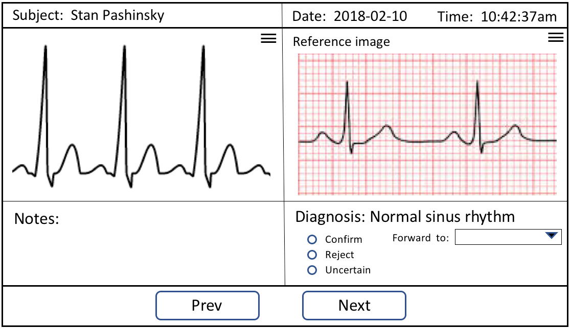 Metis Project 3. Cardiac Arrhythmia Classification and the Toc-Tic ...