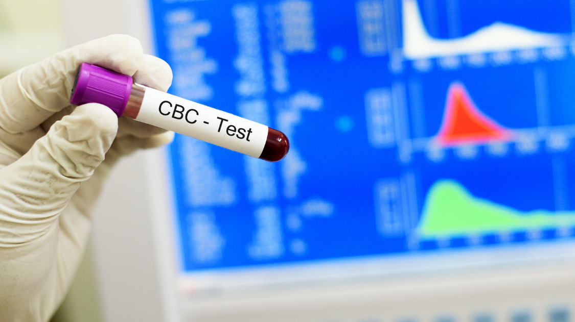 How to Prepare for a CBC Blood Test: Tips and Guidelines | by ...