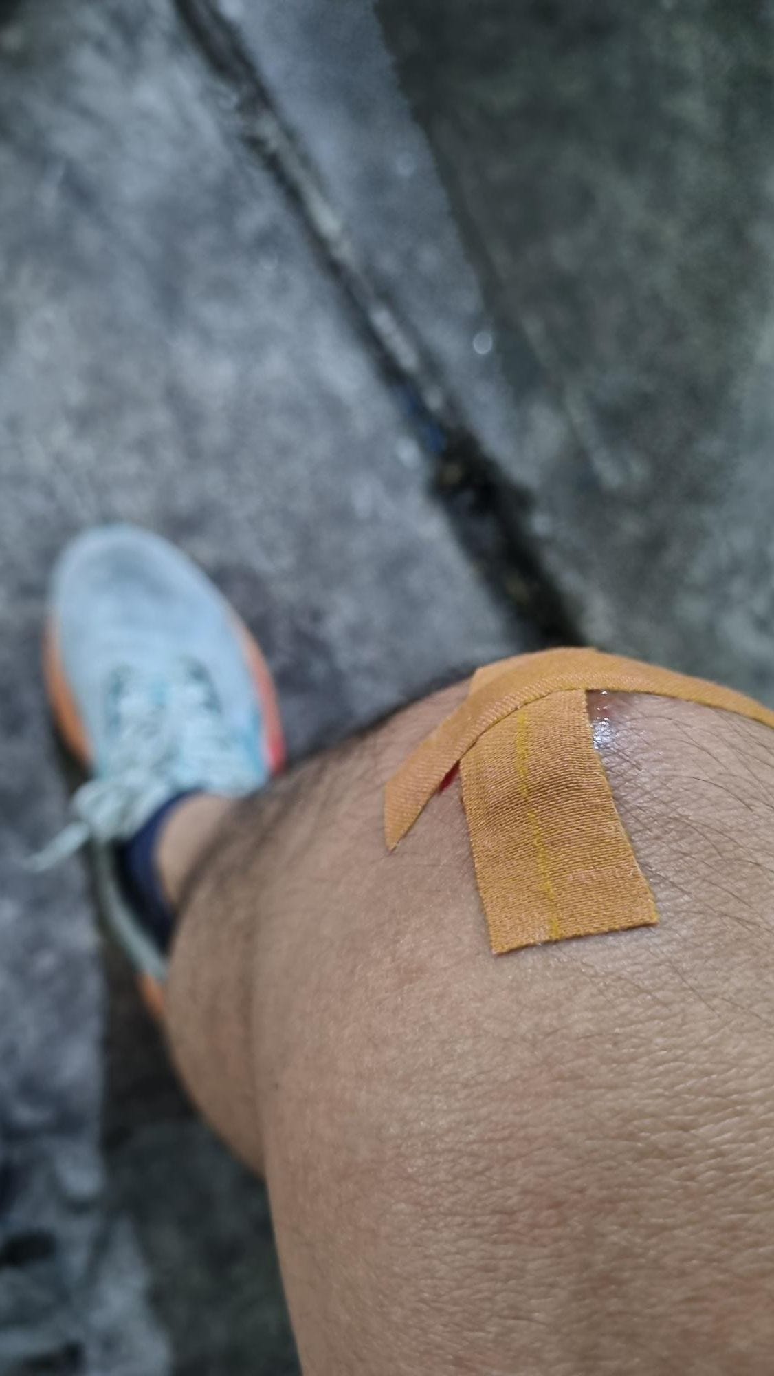 Luka di lutut setelah dikasih hansaplast