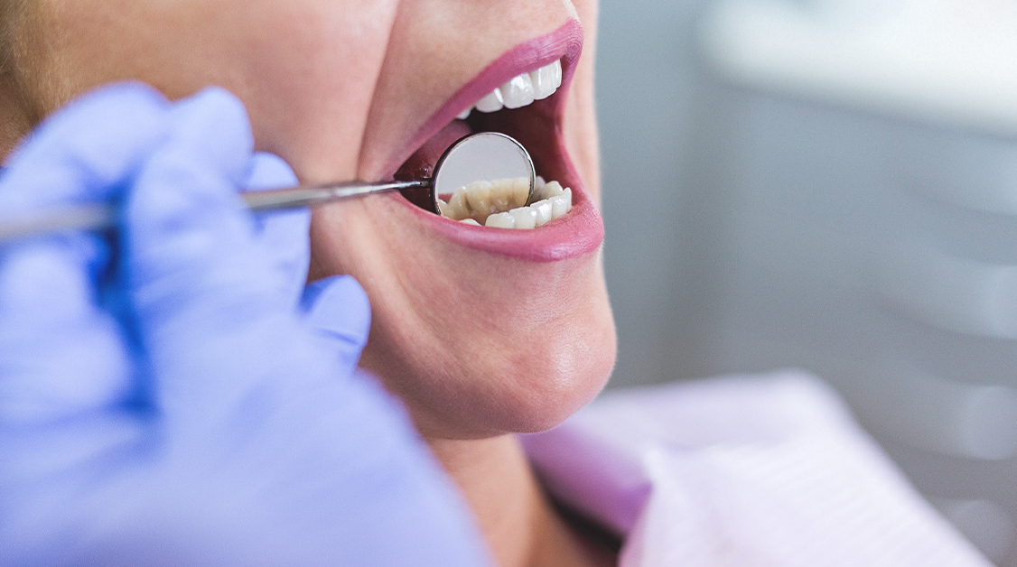 Why Are My Teeth Sensitive? (And What to Do About It) by Dental World
