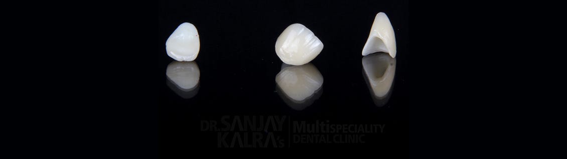 Dental CAD/CAM, the Contemporary Technique to Process Crowns | by Dr ...