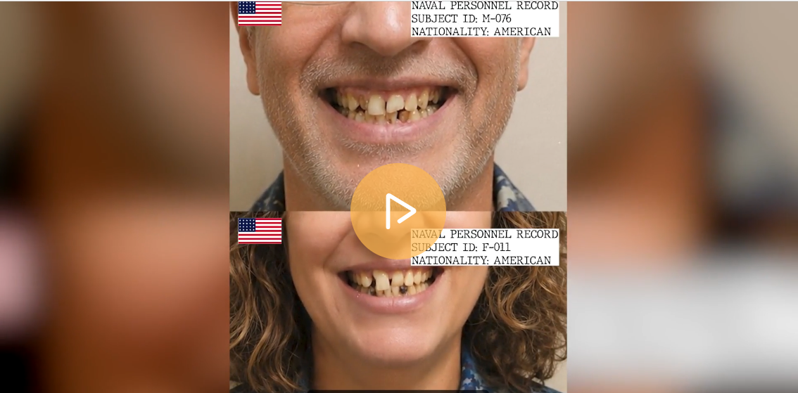 Viking-Era Morning ritual reverses 20 year of Tooth Decay