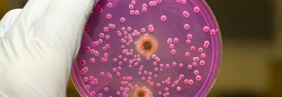 Mold Assessments Vancouver | Mold Testing Services