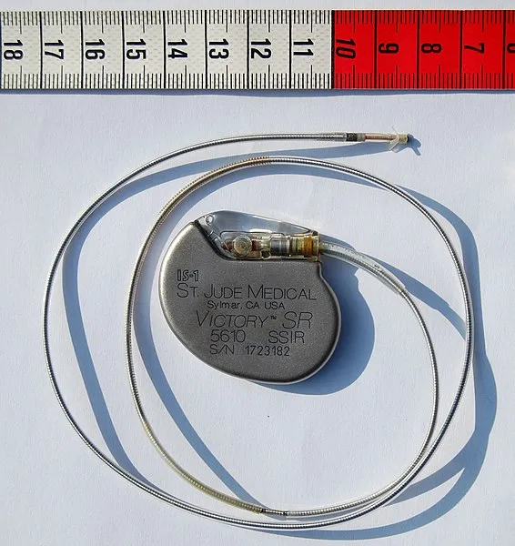 The first human with an implanted heart pacemaker