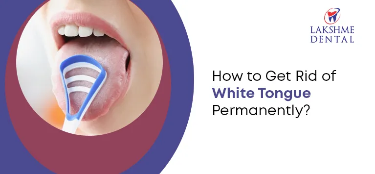 What are the permanent solutions for eliminating white tongue?