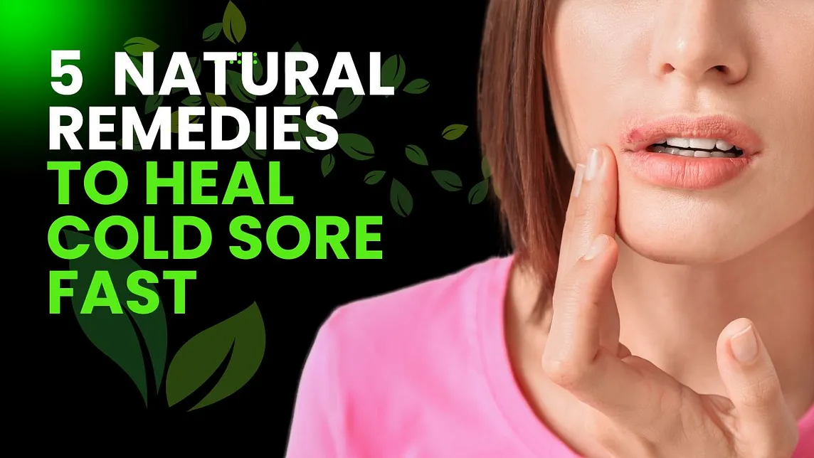 5 Natural Remedies to Heal Cold Sores Fast