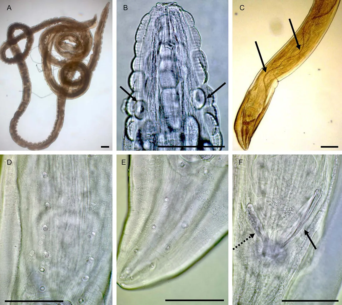 The Fascinating Plant Parasites —  Nematodes