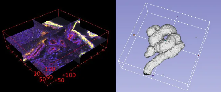 Review: 3D U-Net — Volumetric Segmentation (Medical Image Segmentation)