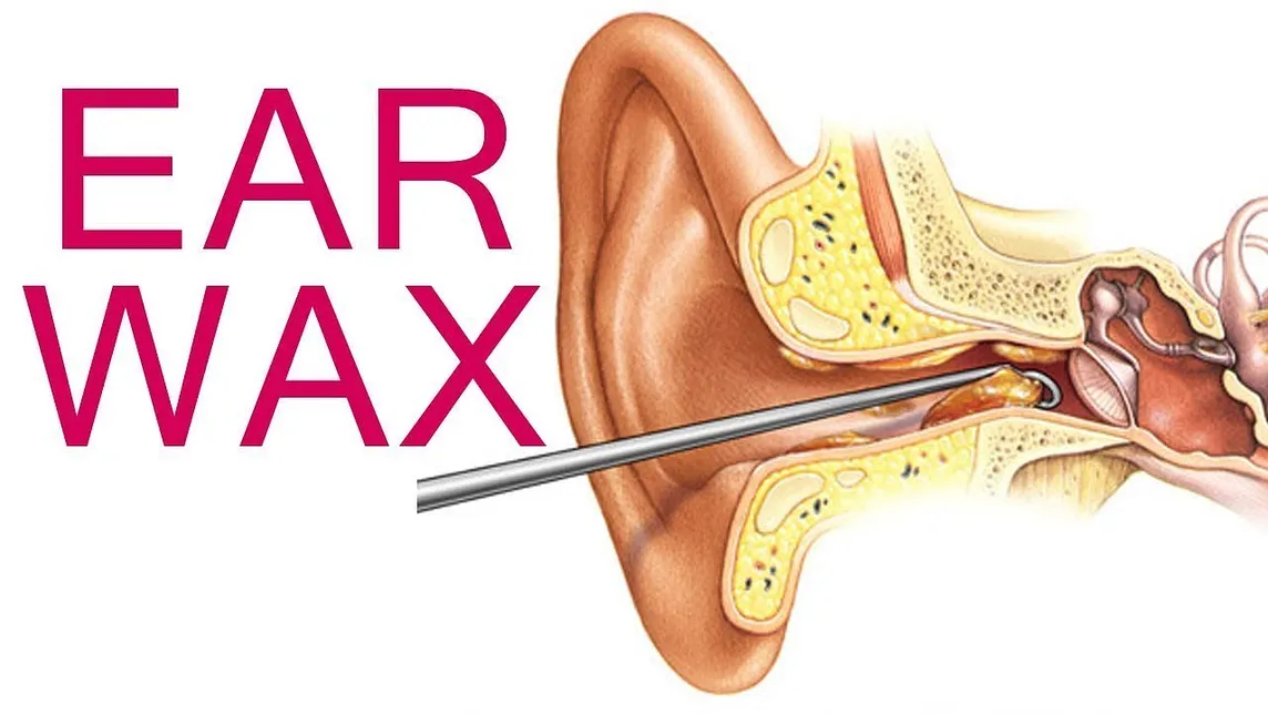 Why Certain Foods Cause Ear Wax: Myths vs Facts