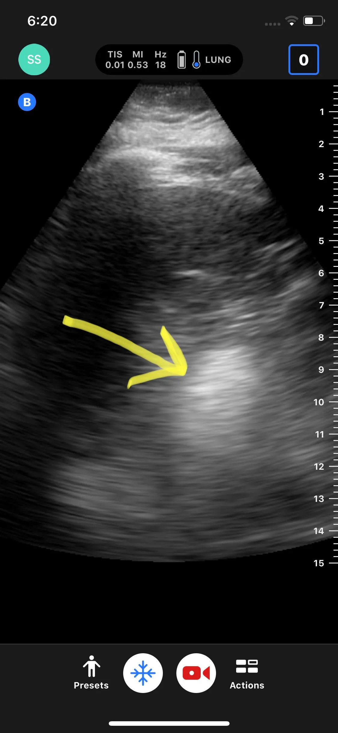 HOCUS POCUS — the Magic of Point of Care Ultrasound in Remote and Rural Medicine.