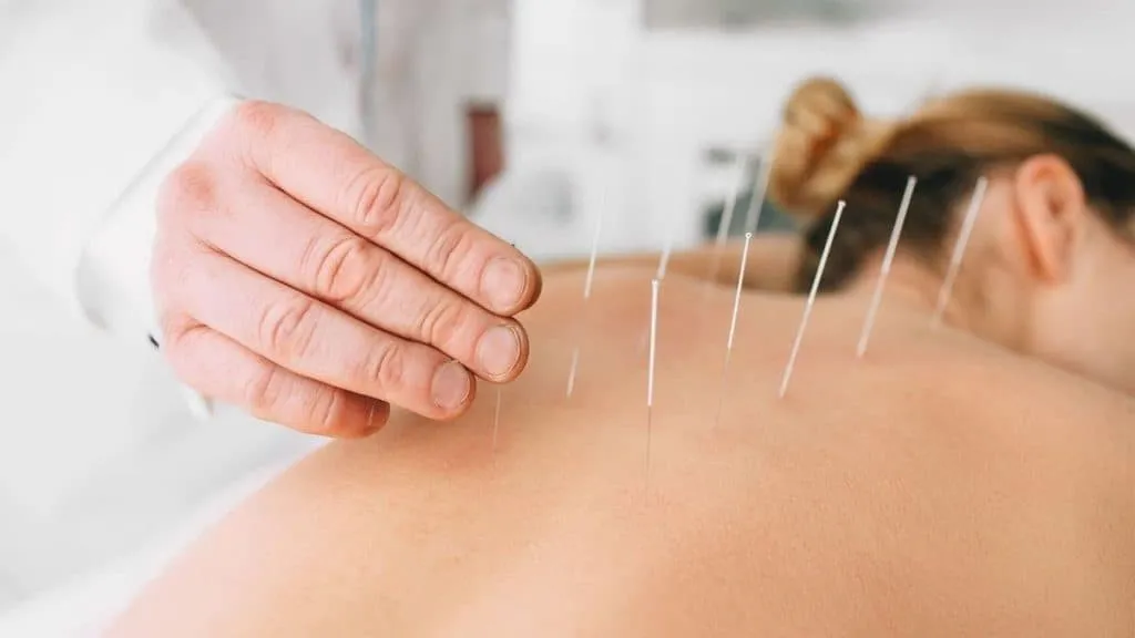 Acupuncture For Back Pain