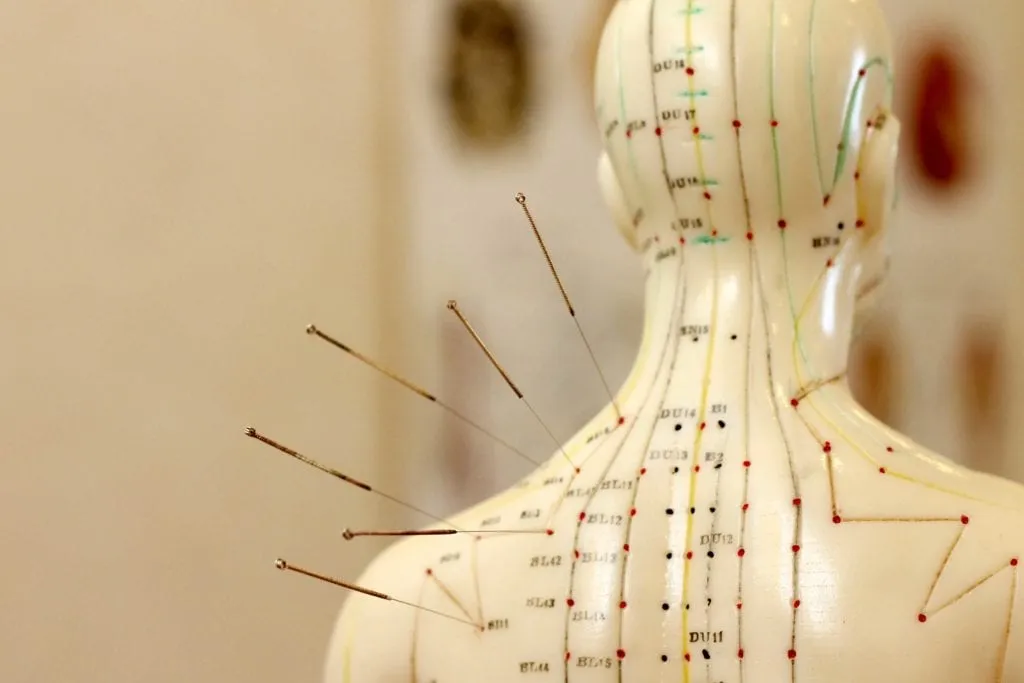 Everything You Need To Know About Acupuncture Therapy