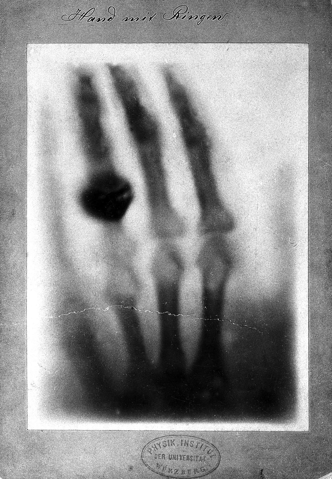 The discovery of X-rays
