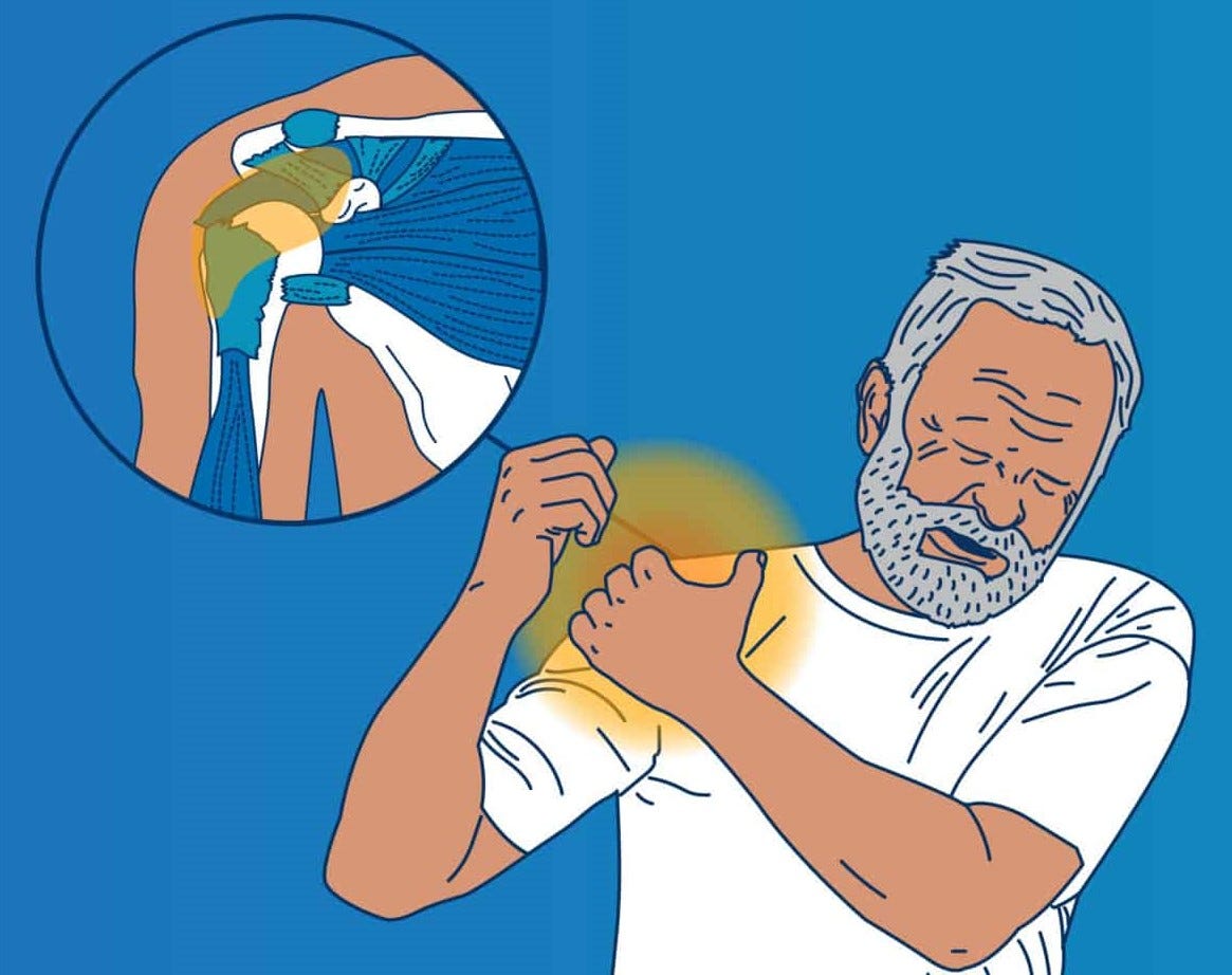 Rotator Cuff Exercises That Can Help You to Prevent Injury by Pankaj