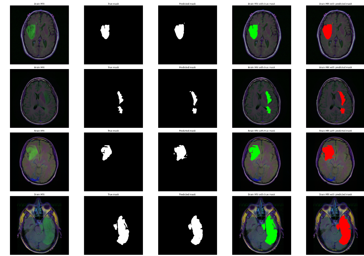 PDF] Brain Tumor Segmentation of MRI Images Using Processed Image Driven  U-Net Architecture