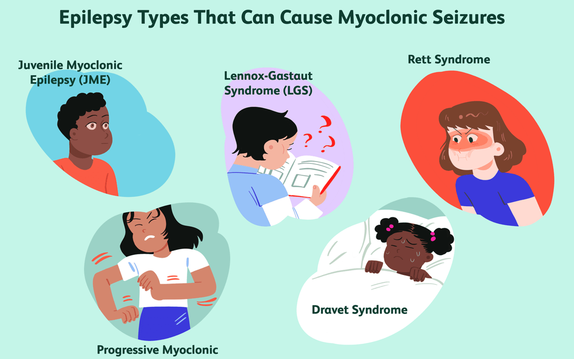 Myoclonic Seizures. A brain tumor is a mass or growth of… | by sinchan ...