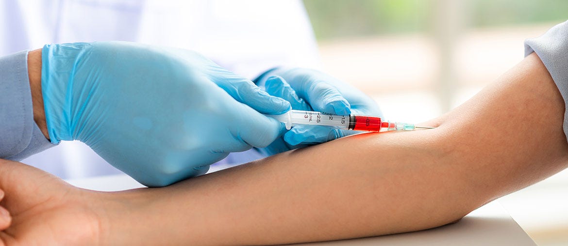 Why Do Blood Test Results Vary With Different Labs? by Dr. B. Lal