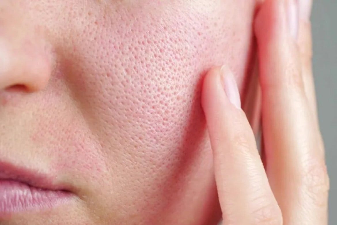 眉間のシワを自然に消す方法