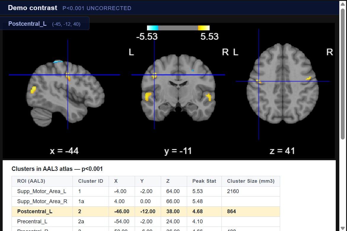 Interactive Brain Activation Maps with Anatomical Labeling: a Python alternative to SPM