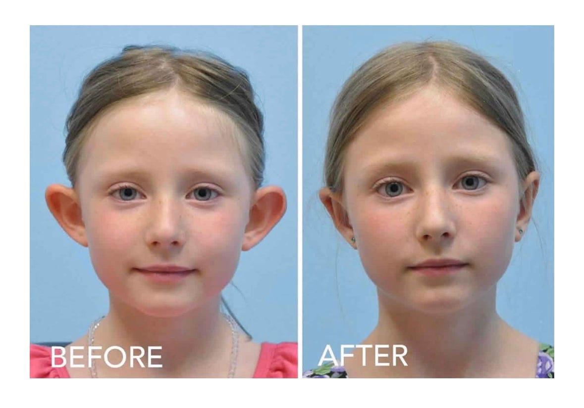 How young is too young for Plastic Surgery? by Mursal Zamanzada Mar, 2023 Medium