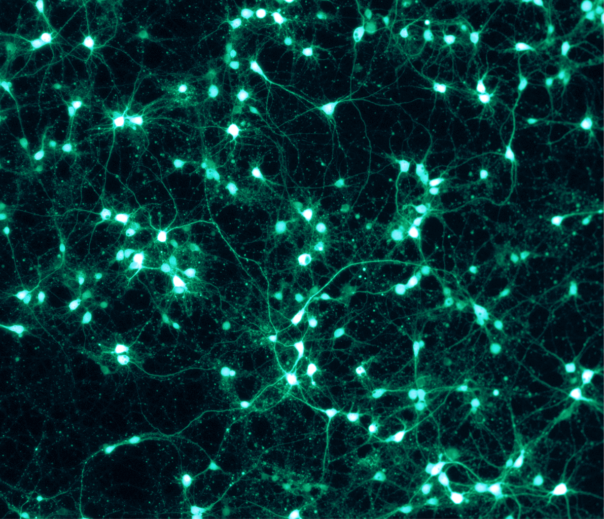 We are entering the era of thought-shaped software