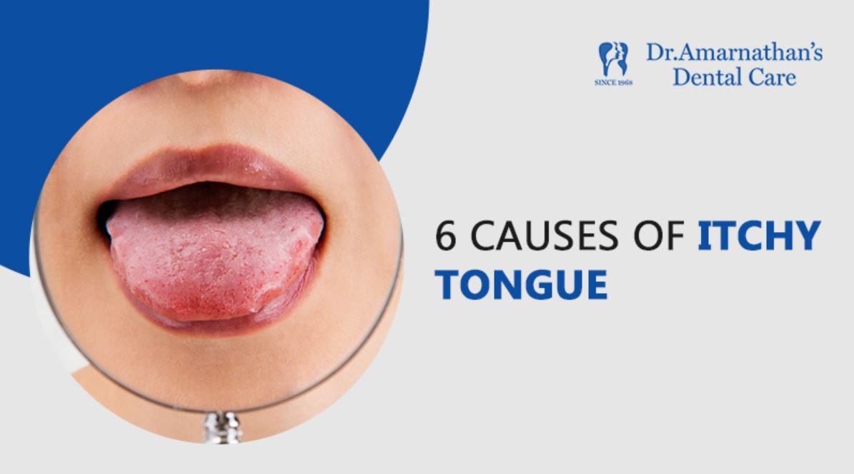 6 causes of itchy tongue. Dr Amarnathan’s Dental Care — Dental… by