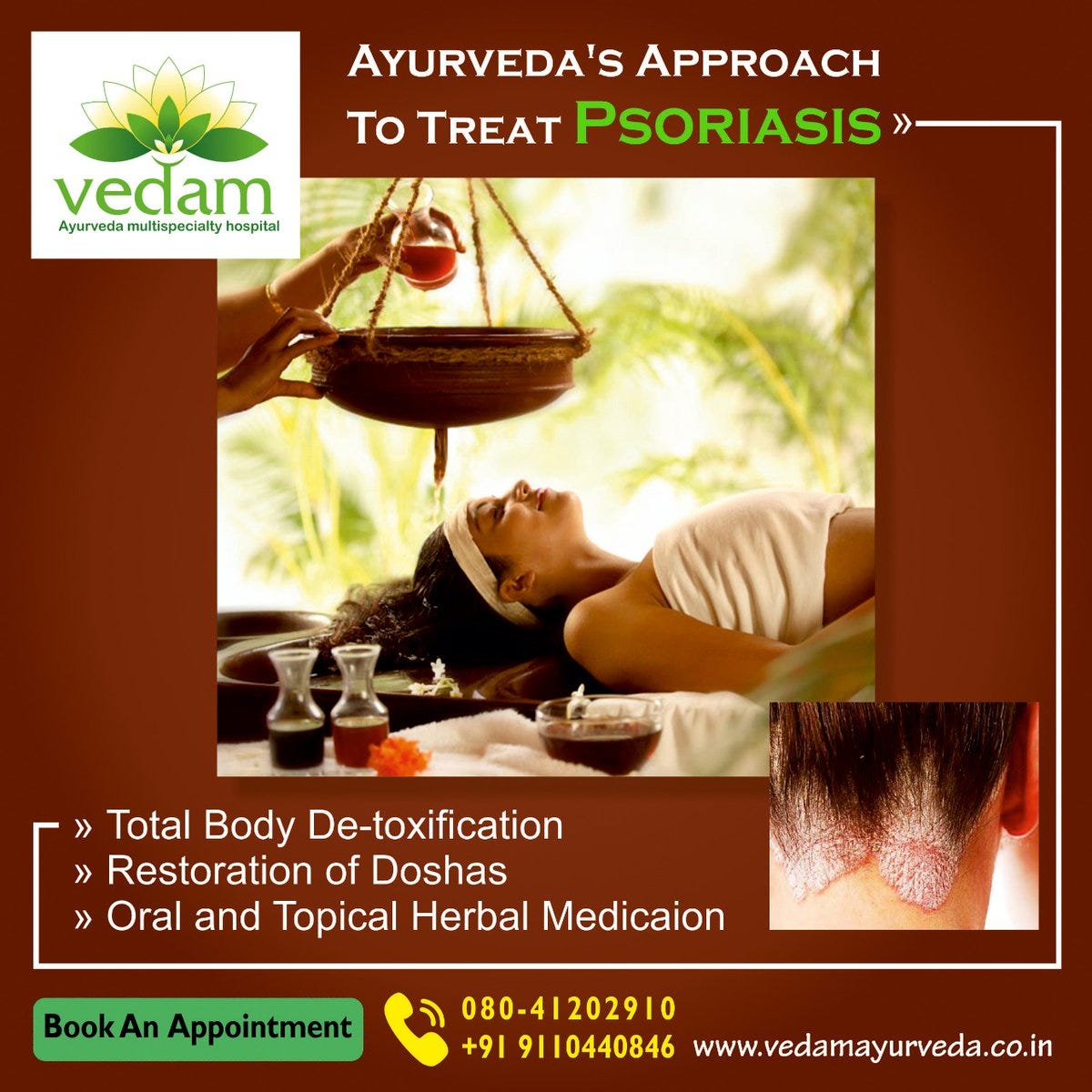 Vedam Ayurvedic Cure For Psoriasis by vedam Ayurveda Medium