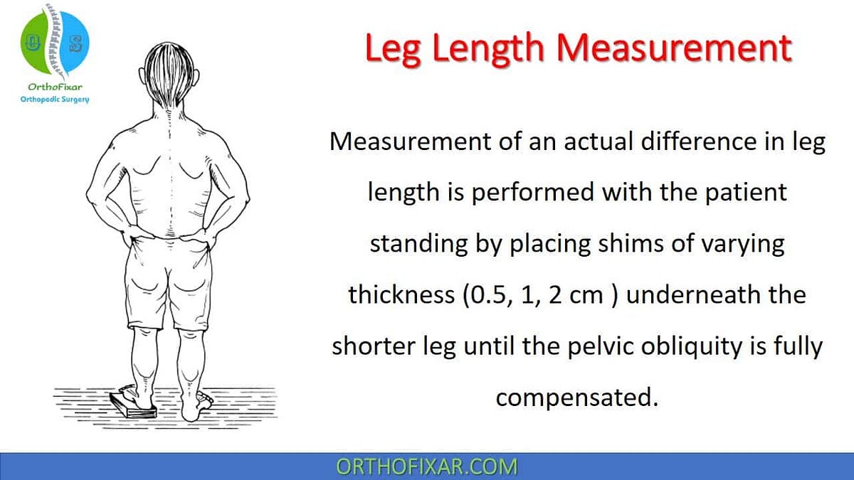 Leg Length Measurement by Orthofixar Orthopedic Jun, 2024 Medium