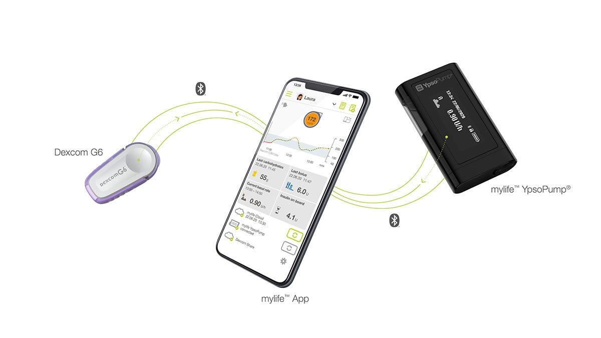 Insulin Pump's integrated with CGM's, The Future Of Type 1