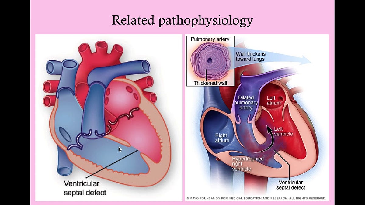 How Do Heart Diseases Affect Pregnancy By Dr Ranjit Jagtap Medium