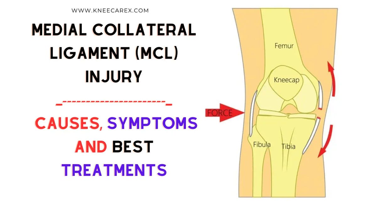 Medial Collateral Ligament (MCL) Injury: Causes, Symptoms And ...