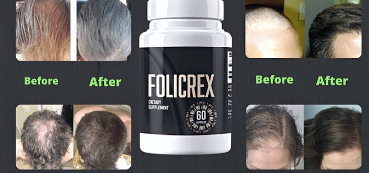 Folicrex Reviews — 100 Safe Supplement For Regrow Your Hair by