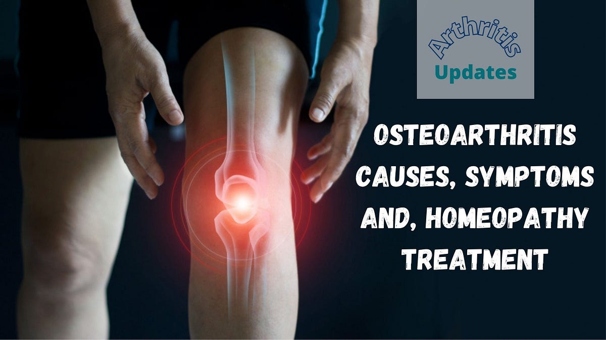 Osteoarthritis Causes Symptoms and Homeopathy Treatment. by