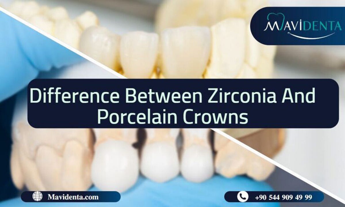 Difference Between Zirconia And Porcelain Crowns by Mavidenta Clinic