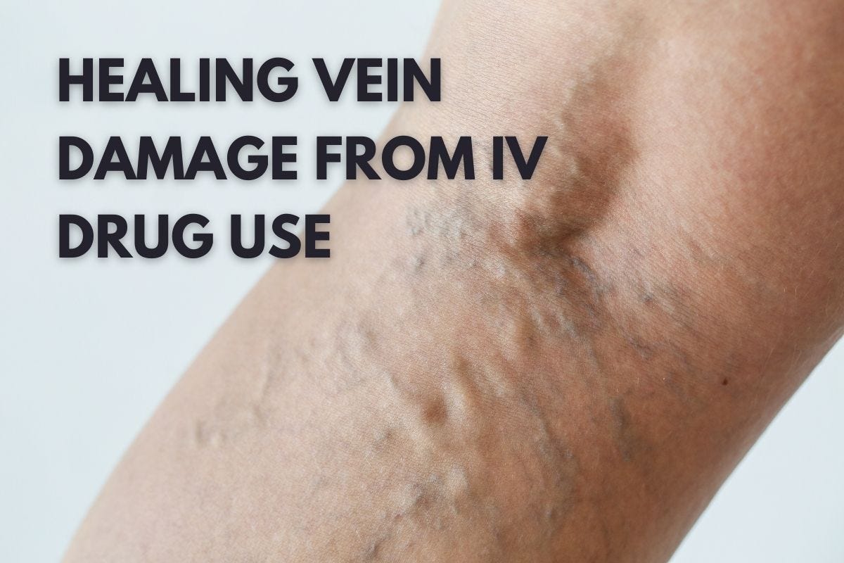How to Support Healing Vein Damage from IV Drug Use by The Freedom
