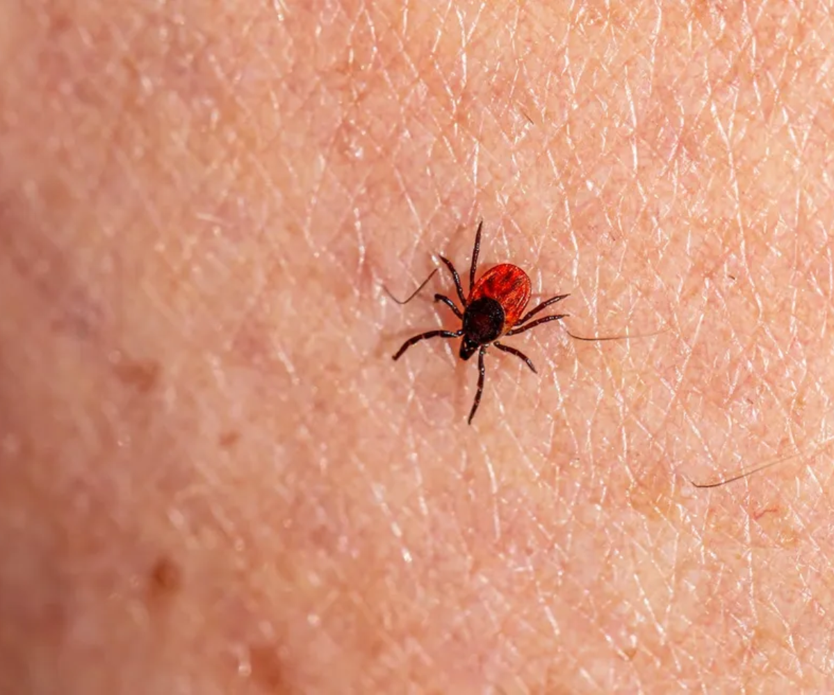 Febre Maculosa: Como Proteger as Crianças