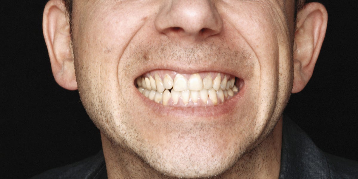 Image of: How Do I Get Over My A**hole Ex? — The Bold Italic — San Francisco