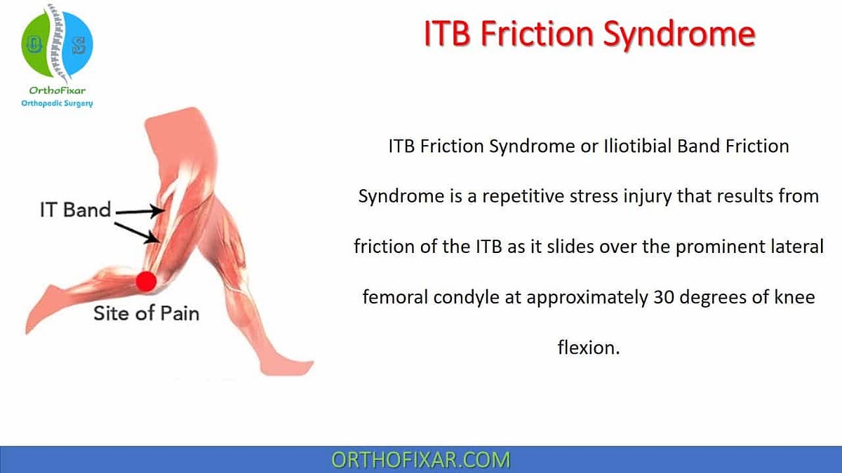 Iliotibial band lengthening (for ITB friction syndrome) Surgical Technique  - OrthOracle