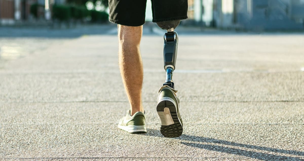 Advancements in Prosthetic and Bionic Legs: A New Era of Mobility and Integration